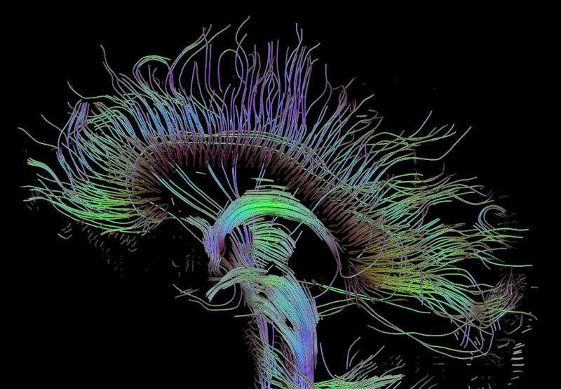 Creative people have better-connected brains, research finds