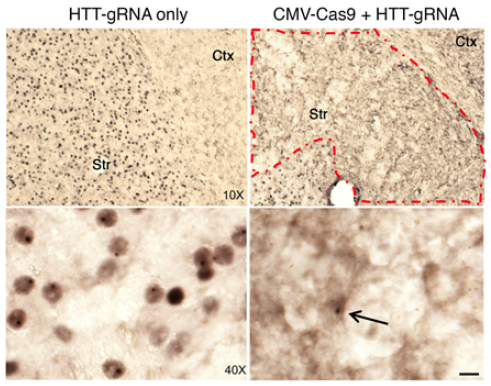 CRISPR/Cas9 gene editing reverses Huntington's in mouse model