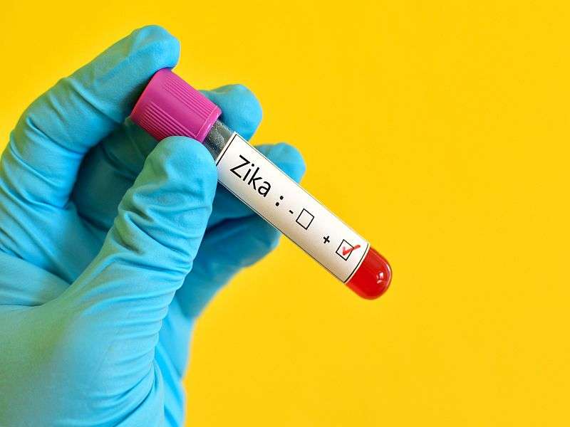 D.C. zika tests were flawed