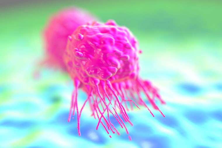Detecting, diagnosing women’s cancers in new ways