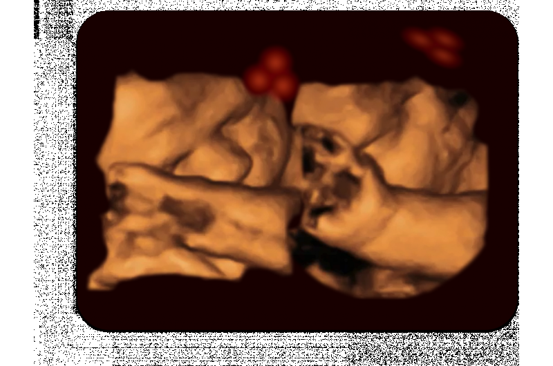 Developing fetuses react to face-like shapes from the womb