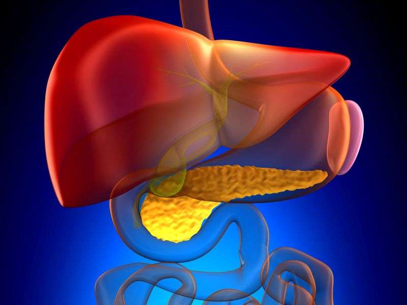 Dietary factors linked to risk of acute pancreatitis