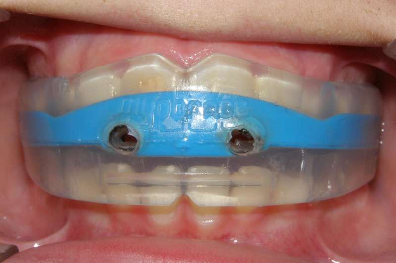 Difficult to get orthodontics to work in younger children