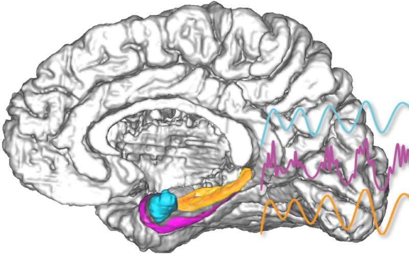 Direct amygdala stimulation can enhance human memory