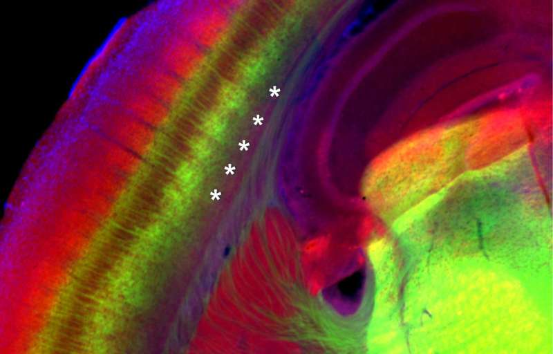 Discovery deepens understanding of brain's sensory circuitry