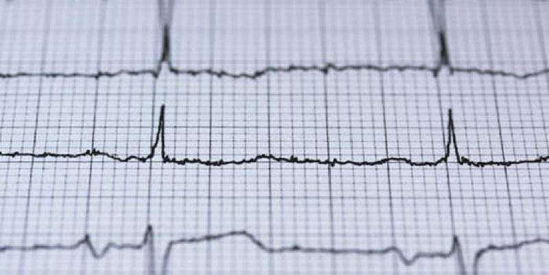 Disparity in care for heart attack patients