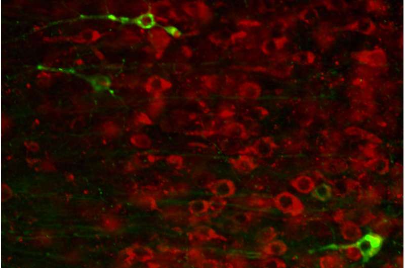 Drug compound halts Alzheimer's-related damage in mice