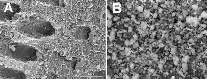Effects of composites containing bioactive glasses on demineralized dentin