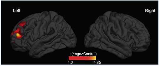 Elderly yoginis have greater cortical thickness