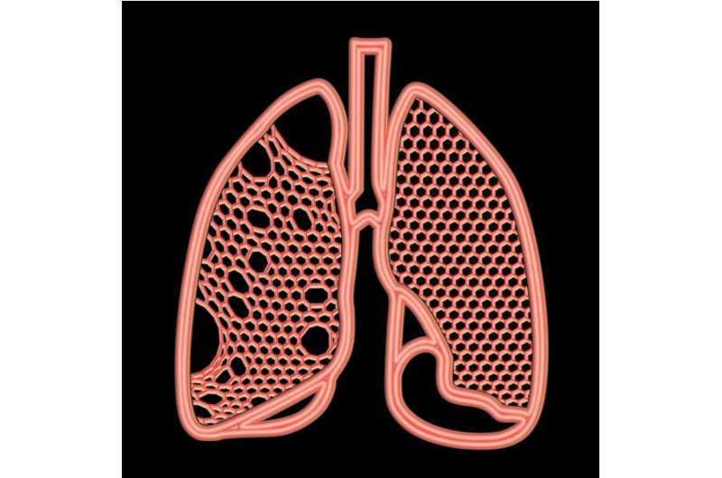 Emphysema treatment could be optimized using network modelling