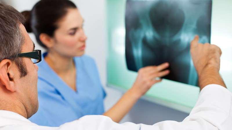 Examining women's bones during menopause may help head off fractures