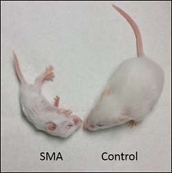 Experiments in mice may help boost newly FDA-approved therapy for spinal muscular atrophy
