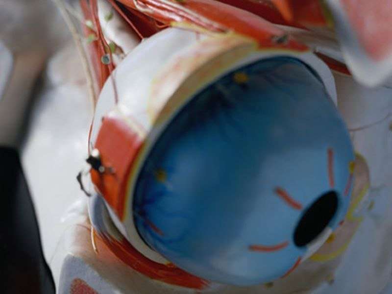 Eyebank corneal tissue prep may increase infection risk