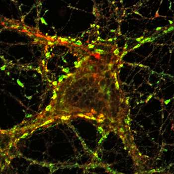 Failure in recycling cellular membrane may be a trigger of Parkinson’s