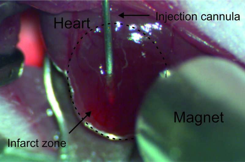 Fighting myocardial infarction with nanoparticle tandems