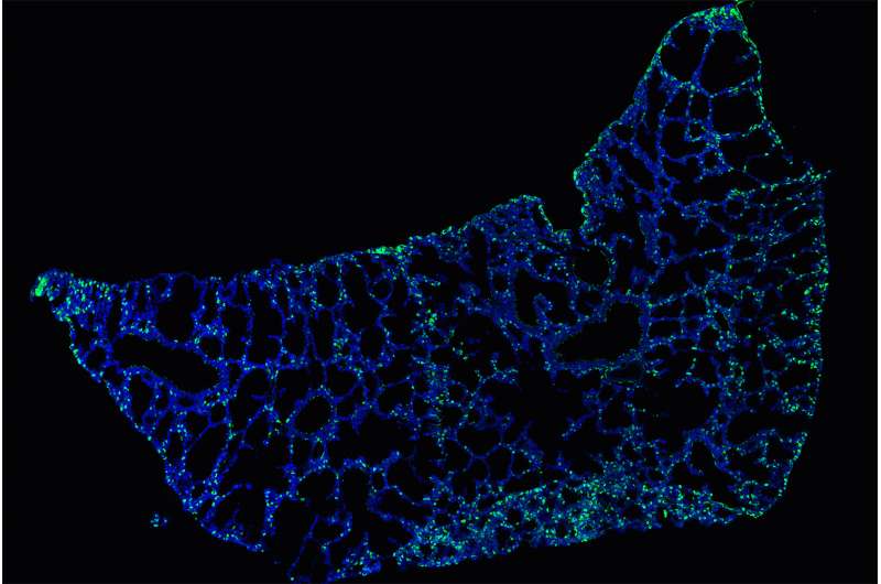 First breath shapes the lung's immune system