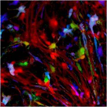 First cell culture of live adult human neurons shows potential of brain cell types