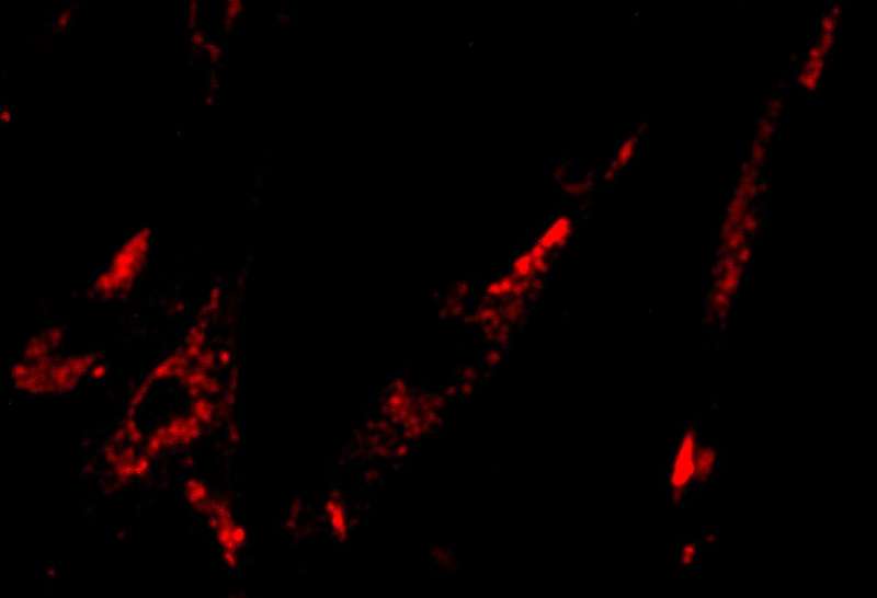 Fluorescent Probe Could Light Up Cancer