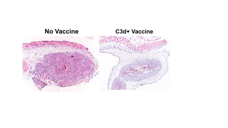 Free C3d regulates immune checkpoint blockade and enhances anti-tumor immunity