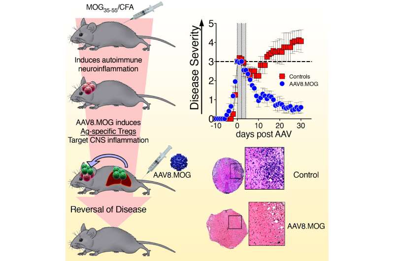 Gene immunotherapy protects against multiple sclerosis in mice