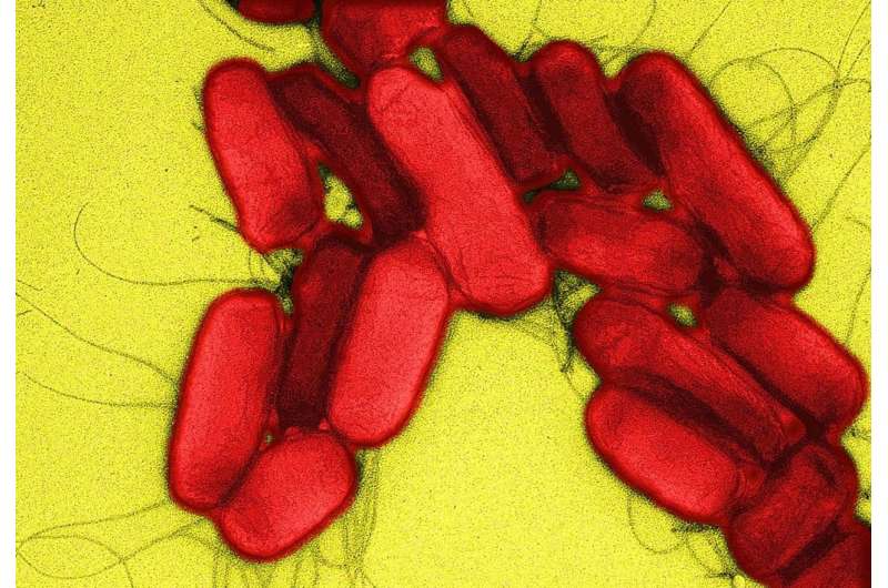 Genome scientists use UK Salmonella cases to shed light on African epidemic