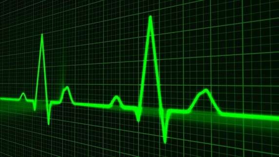 Heart muscle disease patients benefit from defibrillator - research