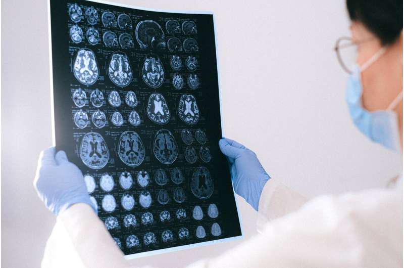 Here's what we think Alzheimer's does to the brain