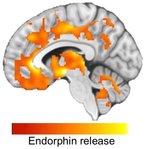 HIIT releases endorphins in the brain