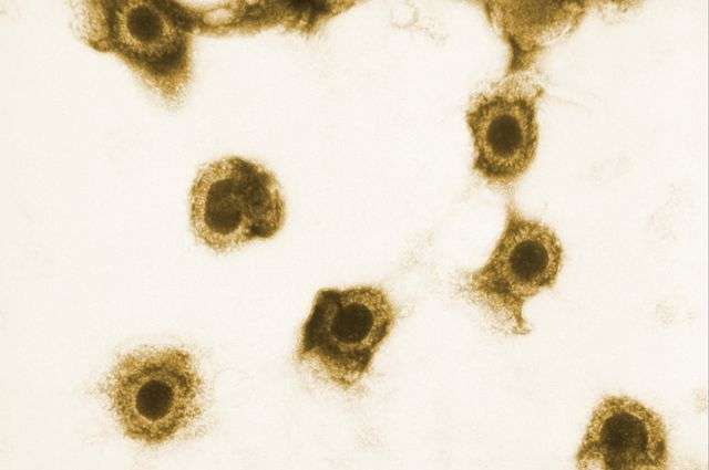 HIV-positive women with cytomegalovirus likelier to pass virus that causes AIDS to infant