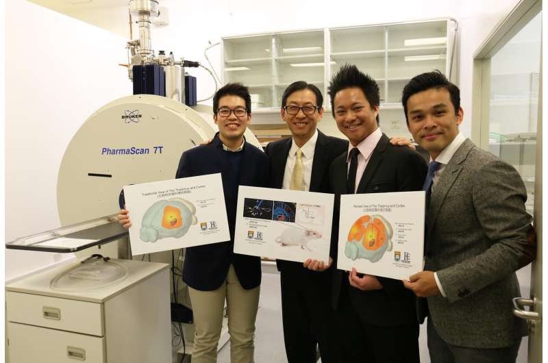 HKU scientists utilise innovative neuroimaging approach to unravel complex brain networks