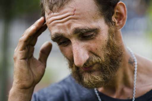 Homeless and on heroin, but turned away from treatment