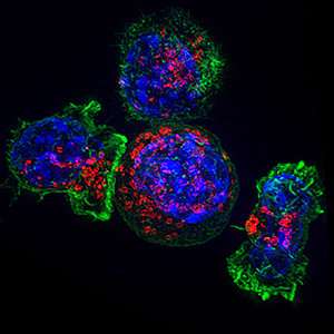 How chronic inflammation tips the balance of immune cells to promote liver cancer
