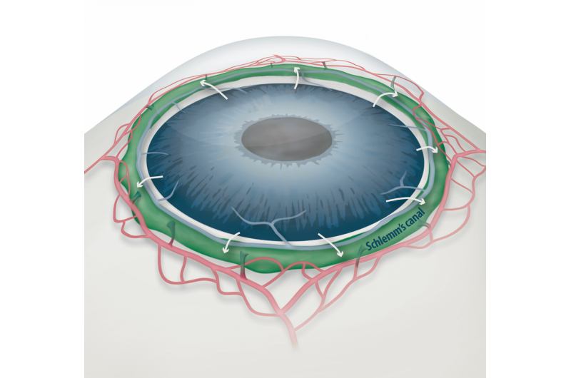 How eyes get clogged in glaucoma and how to free them