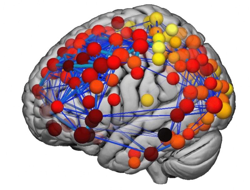 How mapping teenagers’ brains has helped us understand more about schizophrenia