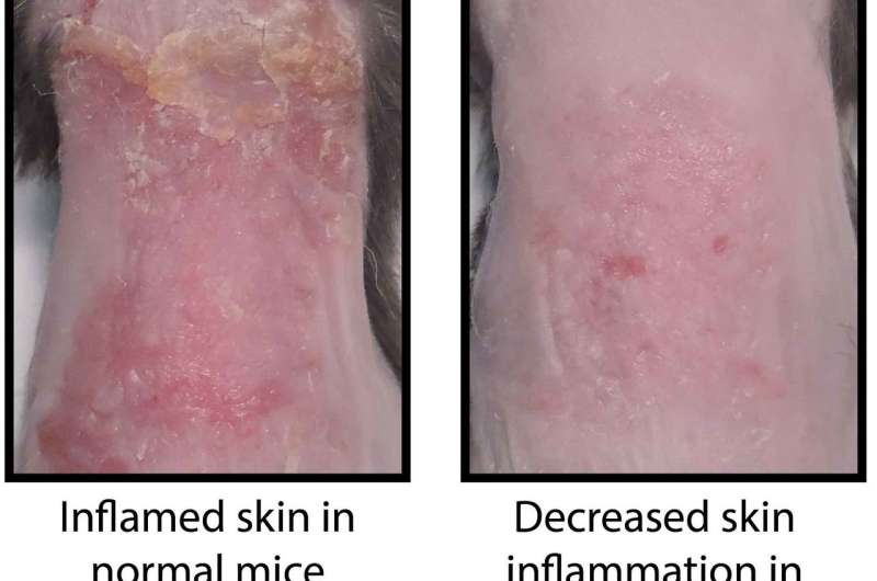 How the skin becomes inflamed