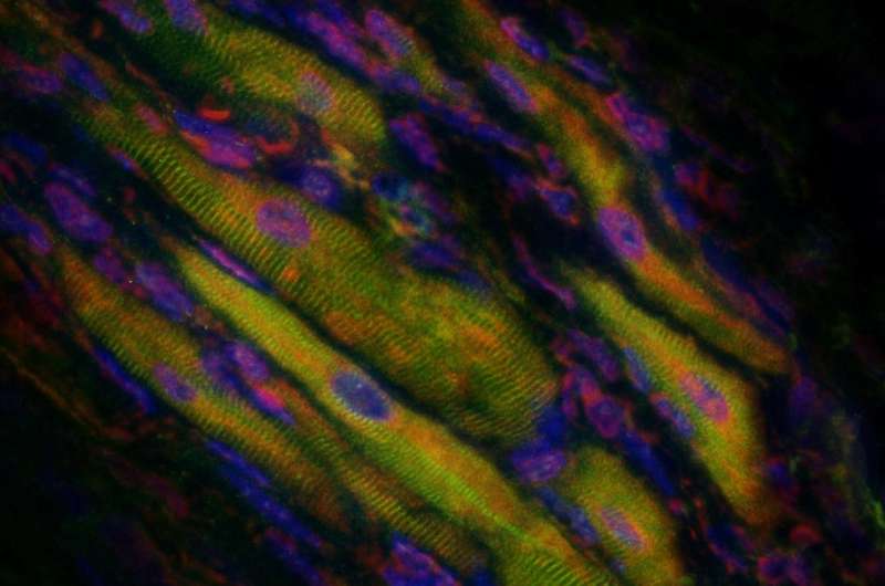 How to turn damaged heart tissue back into healthy heart muscle: New details emerge