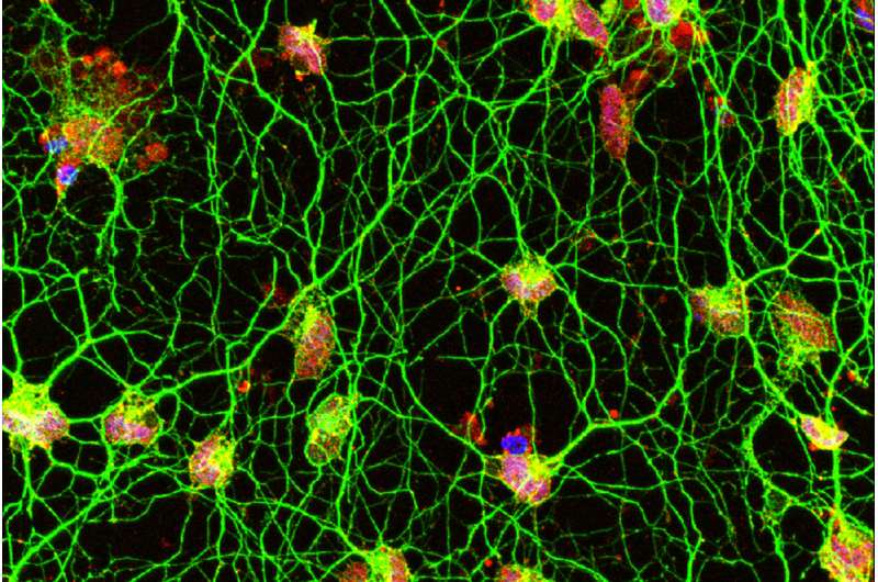 Human skin cells transformed directly into motor neurons