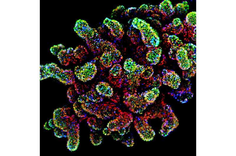 Human tissue model developed to test colon cancer drugs