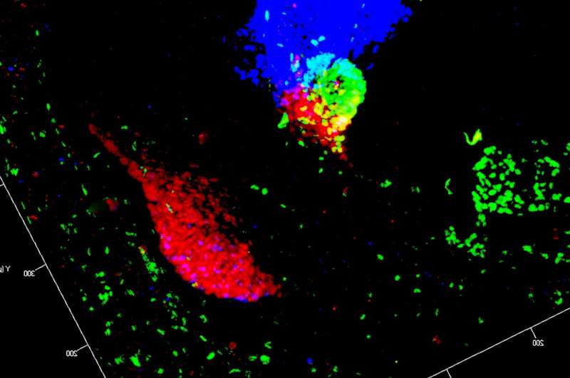 Inducing an identity crisis in liver cells may help diabetics