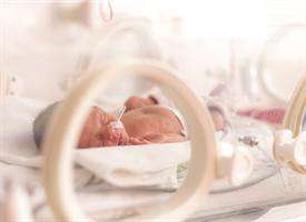 Infants born preterm may lack key lung cells later in life