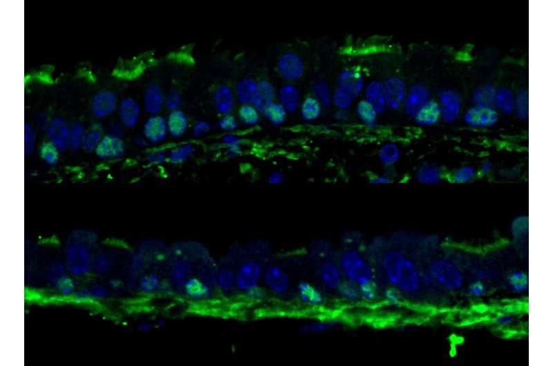 Inhibiting TOR boosts regenerative potential of adult tissues