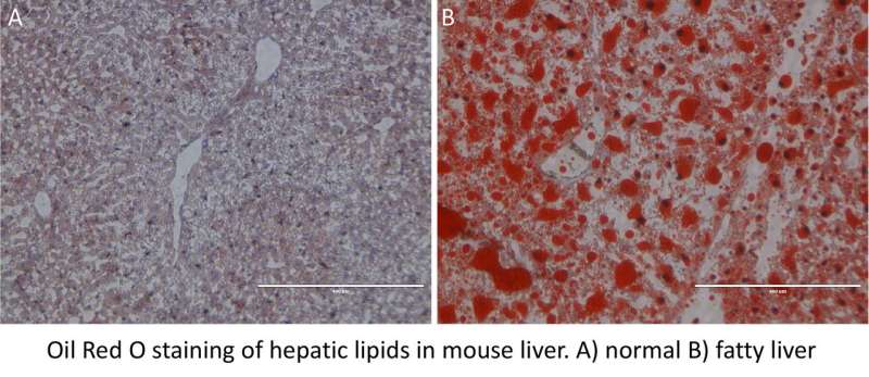 Insulin signaling molecule in liver controls levels of triglyceride in blood