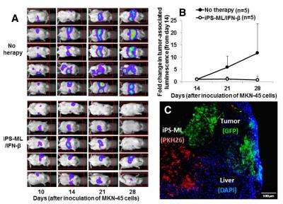 Interferon-beta producing stem cell-derived immune cell therapy on liver cancer