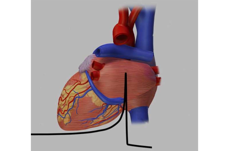 Ion treatments for cardiac arrhythmia