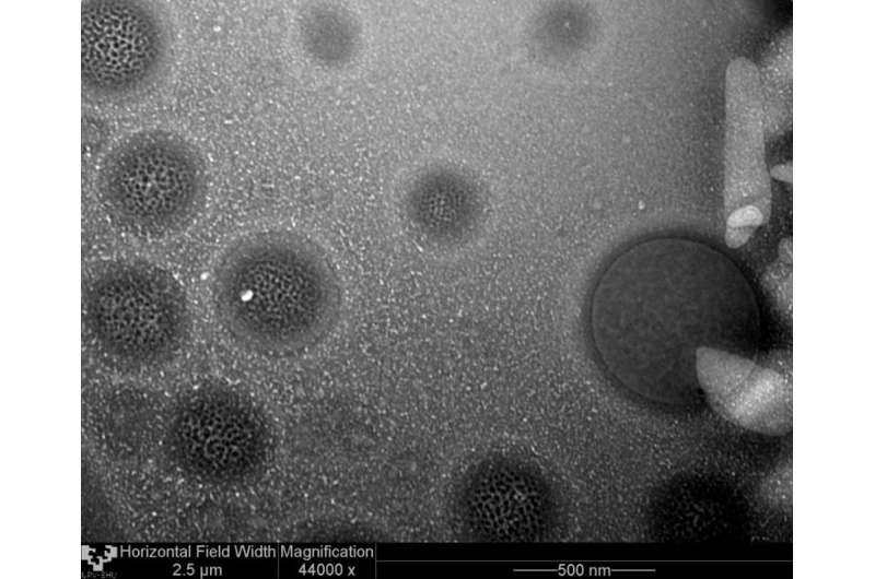 Lipid nanoparticles for gene therapy
