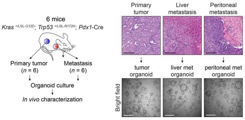 Long-sought mechanism of metastasis is discovered in pancreatic cancer