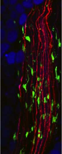 Making fat mice lean: Novel immune cells control neurons responsible for fat breakdown