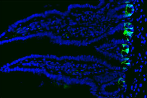 Mature cells revert to stem cells to boost tissue regeneration and repair in mouse intestines