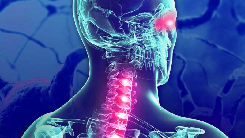 Mayo Clinic develops neuro test that distinguishes demyelinating diseases from multiple sclerosis