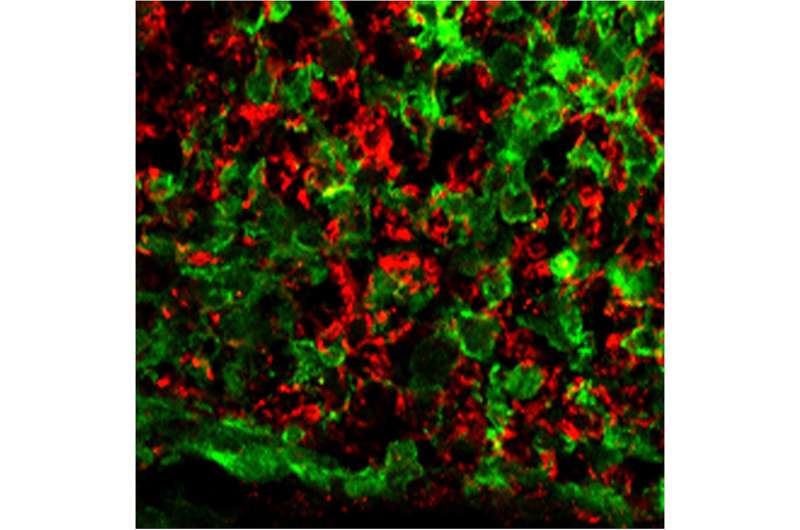 MicroRNA treatment restores nerve insulation, limb function in mice with MS